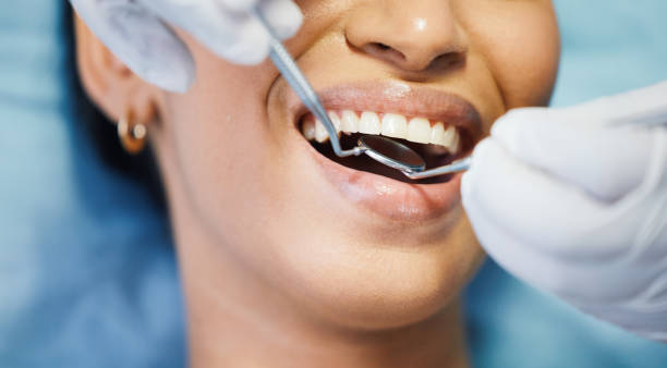 Best Emergency Denture Repair in Bagdad, FL
